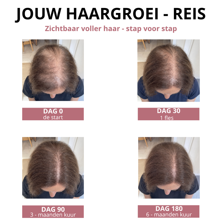 Ricé — Rijstwater Haarserum