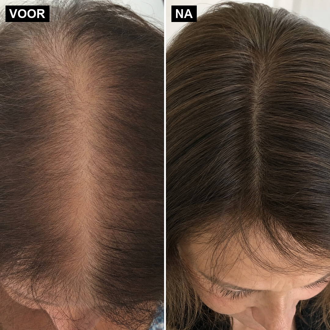 Ricé — Rijstwater Haarserum